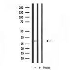 RPS4X Antibody in Western Blot (WB)