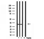 RPS4X Antibody in Western Blot (WB)
