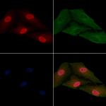 RPL15 Polyclonal Antibody