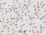 RPL15 Antibody in Immunohistochemistry (Paraffin) (IHC (P))