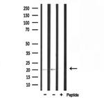 RPL15 Antibody in Western Blot (WB)