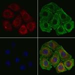 RPL17 Polyclonal Antibody