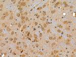 RPL34 Antibody in Immunohistochemistry (Paraffin) (IHC (P))