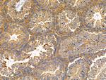 RPL35 Antibody in Immunohistochemistry (Paraffin) (IHC (P))