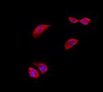 RPL5 Polyclonal Antibody