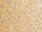 ABHD2 Antibody in Immunohistochemistry (Paraffin) (IHC (P))