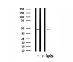 ABHD8 Polyclonal Antibody