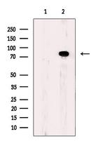ACSS2 Antibody in Western Blot (WB)