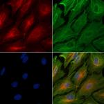 ADAM32 Polyclonal Antibody