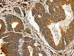 ADAMTS19 Polyclonal Antibody