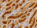 SLC25A6 Polyclonal Antibody