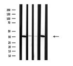 SLC25A31 Antibody in Western Blot (WB)