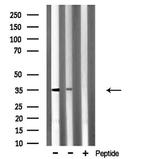 SLC25A31 Antibody in Western Blot (WB)