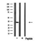 BST-1 Antibody in Western Blot (WB)