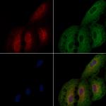 BST-1 Polyclonal Antibody