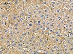 ARFGAP3 Antibody in Immunohistochemistry (Paraffin) (IHC (P))