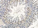 ARFGAP3 Antibody in Immunohistochemistry (Paraffin) (IHC (P))