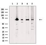 ARFGAP3 Antibody in Western Blot (WB)