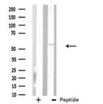 ARFGAP3 Antibody in Western Blot (WB)