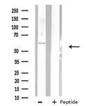 PHYKPL Antibody in Western Blot (WB)