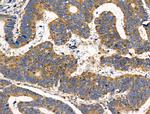 Alpha Sarcoglycan Antibody in Immunohistochemistry (Paraffin) (IHC (P))