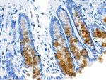 Alpha Sarcoglycan Antibody in Immunohistochemistry (Paraffin) (IHC (P))