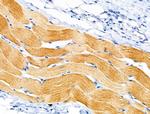 Alpha Sarcoglycan Antibody in Immunohistochemistry (Paraffin) (IHC (P))