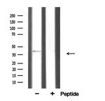 Alpha Sarcoglycan Antibody in Western Blot (WB)