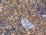 PAT1 Antibody in Immunohistochemistry (Paraffin) (IHC (P))