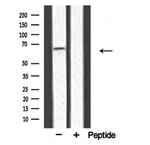 PAT1 Antibody in Western Blot (WB)