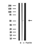 TMEM237 Antibody in Western Blot (WB)