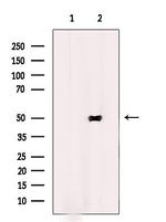 TMEM237 Polyclonal Antibody