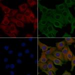 ANGPTL7 Polyclonal Antibody