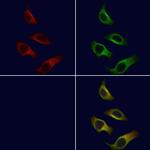 ARMC6 Polyclonal Antibody