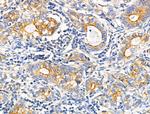 ARMC6 Antibody in Immunohistochemistry (Paraffin) (IHC (P))