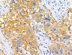 ARMC6 Antibody in Immunohistochemistry (Paraffin) (IHC (P))