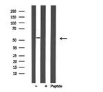 ARMC6 Antibody in Western Blot (WB)