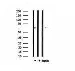 ARSI Antibody in Western Blot (WB)
