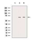 ARSI Polyclonal Antibody