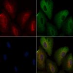 ATXN2L Polyclonal Antibody