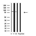 ATXN7L2 Polyclonal Antibody