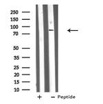 DDX50 Antibody in Western Blot (WB)