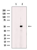 GCNT7 Polyclonal Antibody