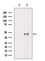 B4GALT1 Polyclonal Antibody