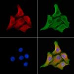 MRP2 Polyclonal Antibody