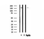 MRP2 Antibody in Western Blot (WB)
