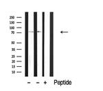 CLIP4 Antibody in Western Blot (WB)