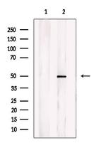 CHST1 Polyclonal Antibody
