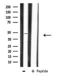 CHST1 Antibody in Western Blot (WB)