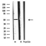 Carboxypeptidase A5 Antibody in Western Blot (WB)